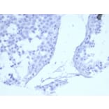 Immunohistochemistry - Anti-EGFR Antibody [EGFR/6390R] (A277974) - Antibodies.com