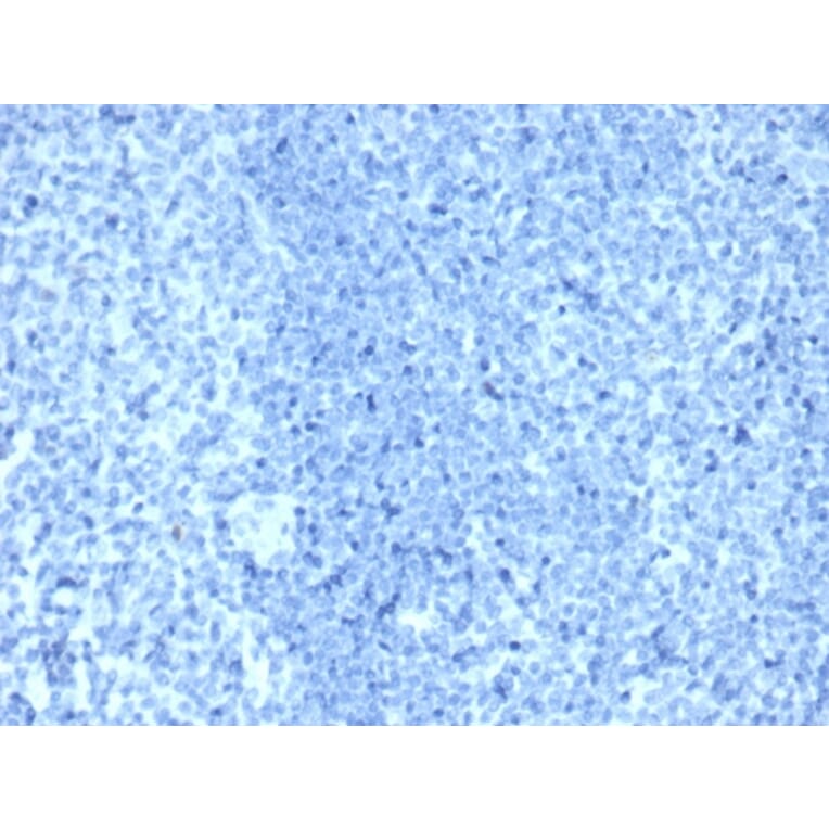 Immunohistochemistry - Anti-HER2 Antibody [ERBB2/4376R] (A277975) - Antibodies.com