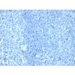 Immunohistochemistry - Anti-HER2 Antibody [ERBB2/4376R] (A277975) - Antibodies.com