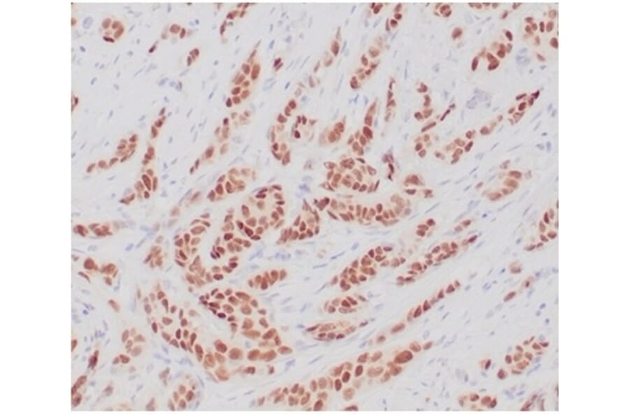 Immunohistochemistry - Anti-Estrogen Receptor alpha Antibody [ESR1/4039R] (A277976) - Antibodies.com