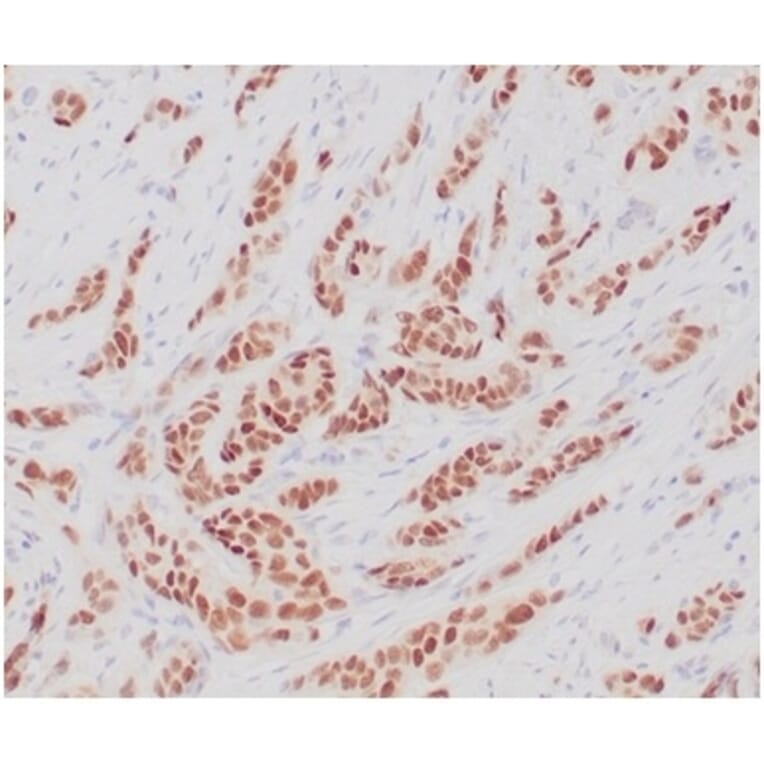 Immunohistochemistry - Anti-Estrogen Receptor alpha Antibody [ESR1/4039R] (A277976) - Antibodies.com