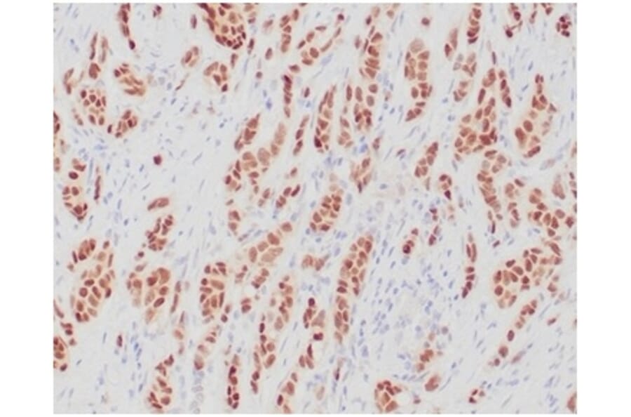 Immunohistochemistry - Anti-Estrogen Receptor alpha Antibody [ESR1/4039R] (A277976) - Antibodies.com