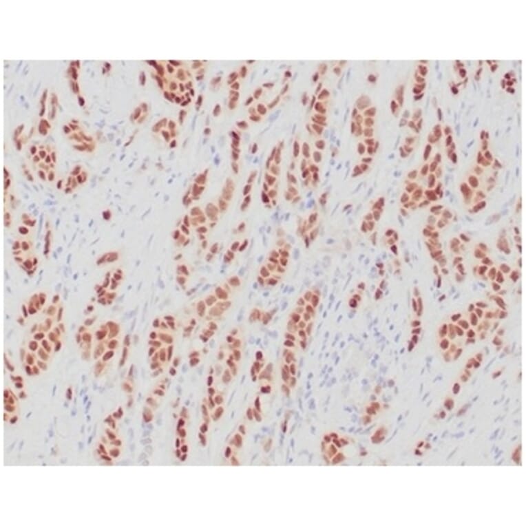 Immunohistochemistry - Anti-Estrogen Receptor alpha Antibody [ESR1/4039R] (A277976) - Antibodies.com