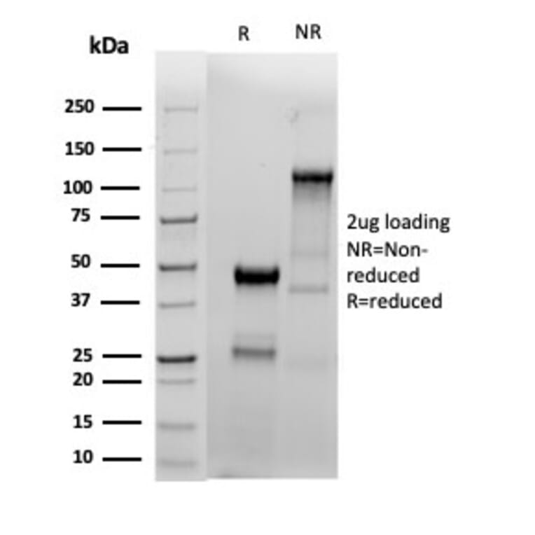 SDS-PAGE - Anti-Estrogen Receptor alpha Antibody [ESR1/4039R] (A277976) - Antibodies.com