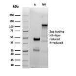 SDS-PAGE - Anti-Estrogen Receptor alpha Antibody [ESR1/4039R] (A277976) - Antibodies.com