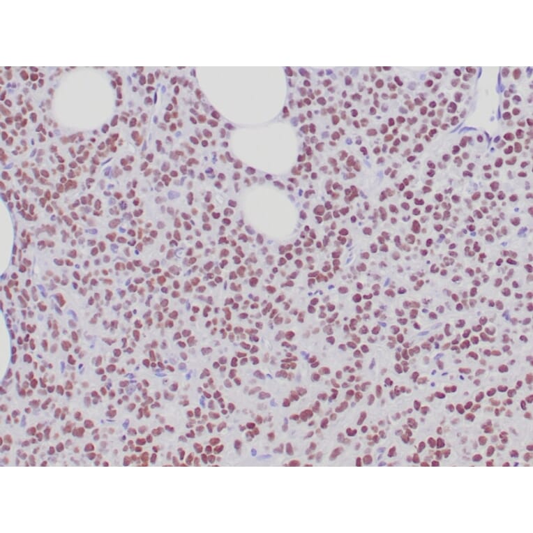 Immunohistochemistry - Anti-Estrogen Receptor alpha Antibody [ESR1/6811R] (A277977) - Antibodies.com