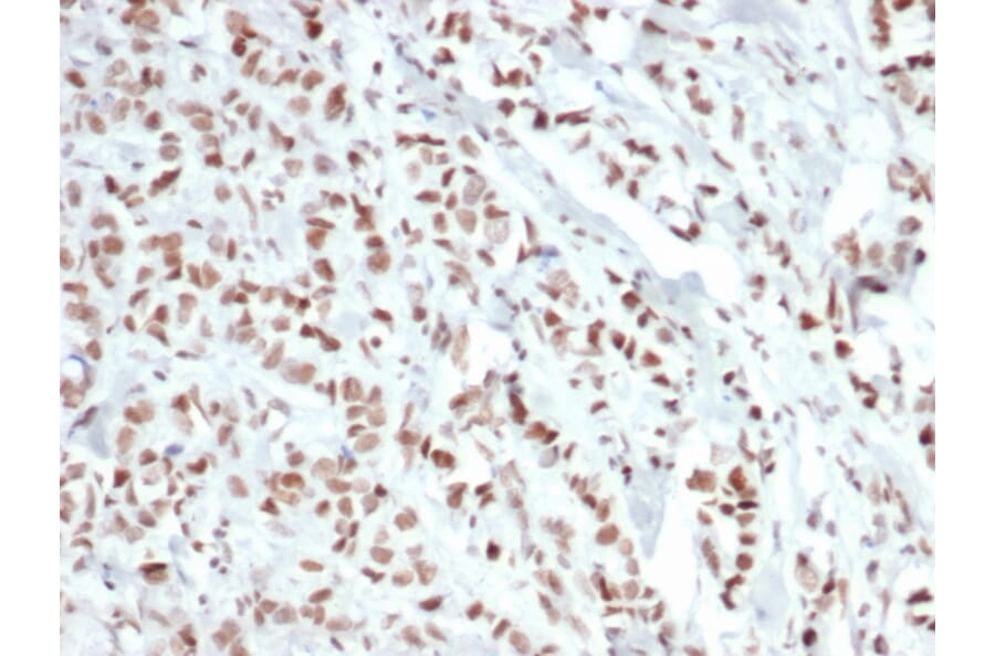 Immunohistochemistry - Anti-Estrogen Receptor alpha Antibody [ESR1/6811R] (A277977) - Antibodies.com