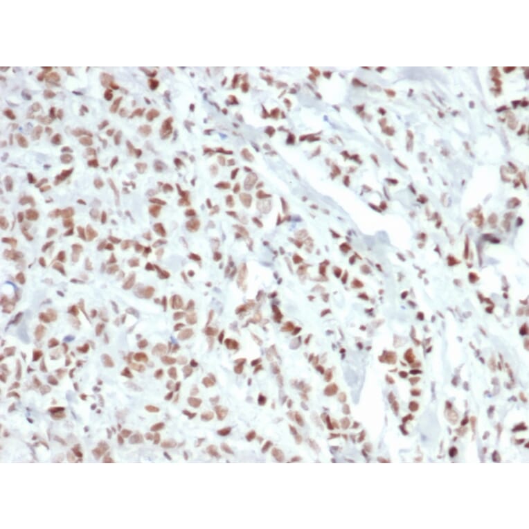 Immunohistochemistry - Anti-Estrogen Receptor alpha Antibody [ESR1/6811R] (A277977) - Antibodies.com