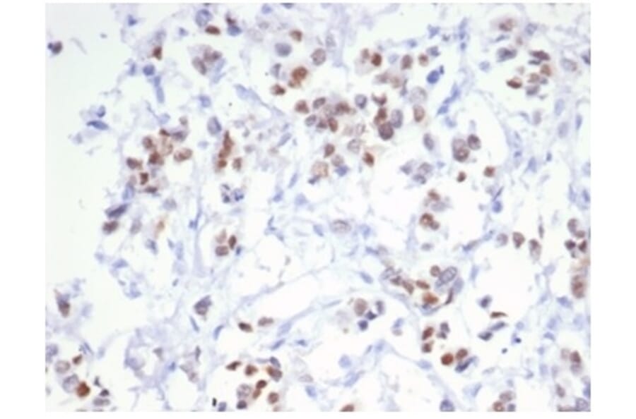 Immunohistochemistry - Anti-Estrogen Receptor alpha Antibody [ESR1/6983R] (A277978) - Antibodies.com