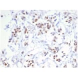 Immunohistochemistry - Anti-Estrogen Receptor alpha Antibody [ESR1/6983R] (A277978) - Antibodies.com