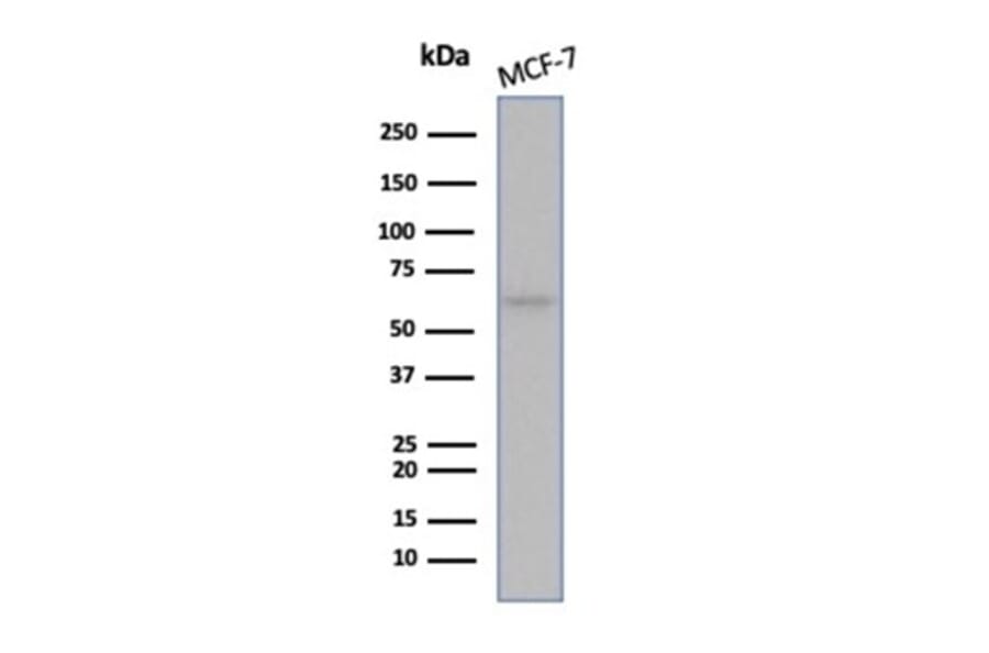 Western Blot - Anti-Estrogen Receptor alpha Antibody [ESR1/6983R] (A277978) - Antibodies.com