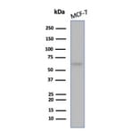 Western Blot - Anti-Estrogen Receptor alpha Antibody [ESR1/6983R] (A277978) - Antibodies.com