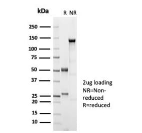 SDS-PAGE - Anti-Estrogen Receptor beta 1 Antibody [ESR2/7006R] (A277979) - Antibodies.com