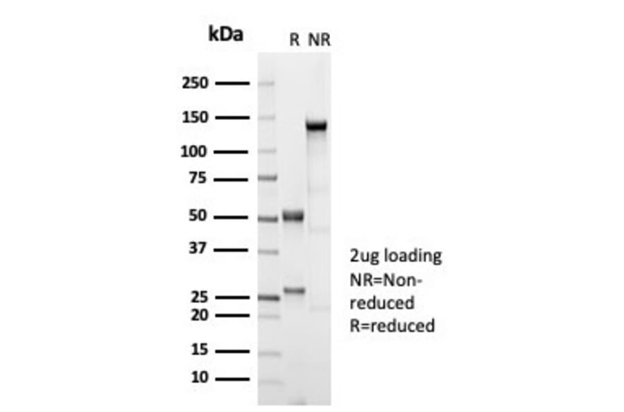SDS-PAGE - Anti-Estrogen Receptor beta 1 Antibody [ESR2/7006R] (A277979) - Antibodies.com