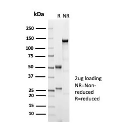 SDS-PAGE - Anti-Estrogen Receptor beta 1 Antibody [ESR2/7006R] (A277979) - Antibodies.com