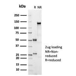 SDS-PAGE - Anti-Estrogen Receptor beta 1 Antibody [ESR2/7006R] (A277979) - Antibodies.com