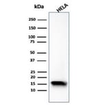 Western Blot - Anti-FABP5 Antibody [FABP5/6353R] (A277981) - Antibodies.com