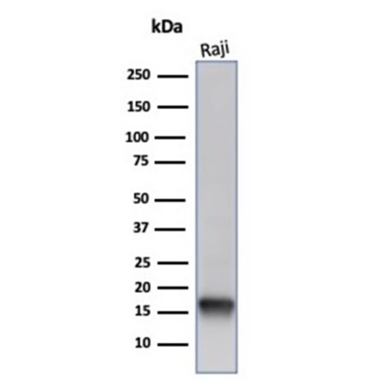 Western Blot - Anti-FABP5 Antibody [FABP5/6353R] (A277981) - Antibodies.com