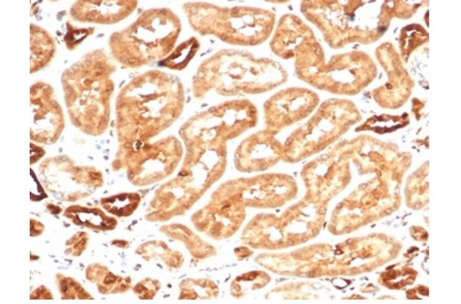 Immunohistochemistry - Anti-AKR1B1 Antibody [AKR1B1/7009R] (A277982) - Antibodies.com