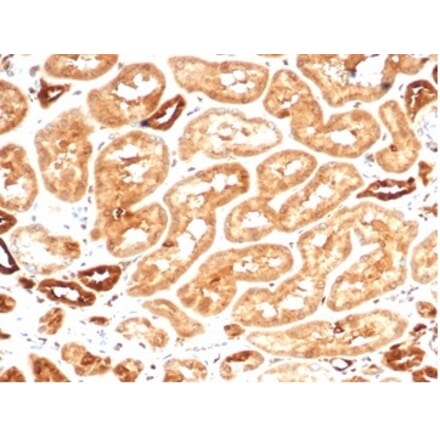 Immunohistochemistry - Anti-AKR1B1 Antibody [AKR1B1/7009R] (A277982) - Antibodies.com