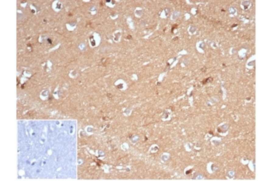 Immunohistochemistry - Anti-AKR1B1 Antibody [AKR1B1/7009R] (A277982) - Antibodies.com