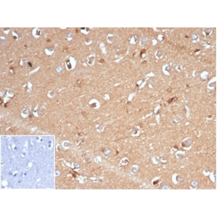 Immunohistochemistry - Anti-AKR1B1 Antibody [AKR1B1/7009R] (A277982) - Antibodies.com