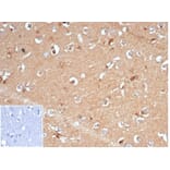 Immunohistochemistry - Anti-AKR1B1 Antibody [AKR1B1/7009R] (A277982) - Antibodies.com