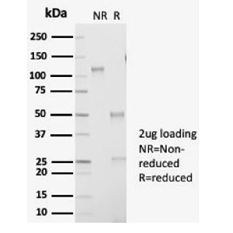 SDS-PAGE - Anti-AKR1B1 Antibody [AKR1B1/7009R] (A277982) - Antibodies.com