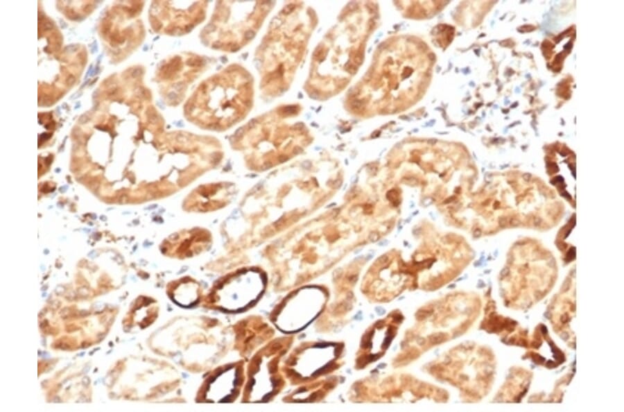 Immunohistochemistry - Anti-AKR1B1 Antibody [AKR1B1/7010R] (A277983) - Antibodies.com