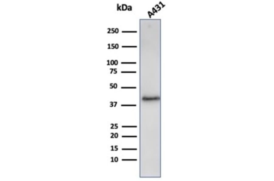 Western Blot - Anti-Filaggrin Antibody [FLG/3909R] (A277984) - Antibodies.com