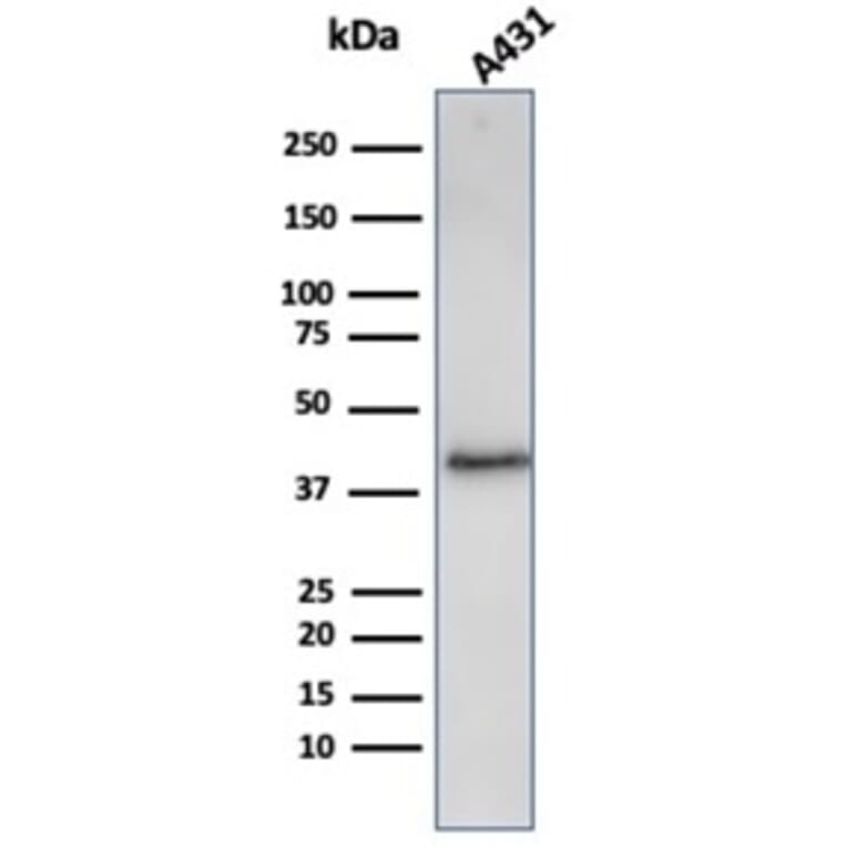 Western Blot - Anti-Filaggrin Antibody [FLG/3909R] (A277984) - Antibodies.com