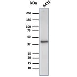 Western Blot - Anti-Filaggrin Antibody [FLG/3909R] (A277984) - Antibodies.com
