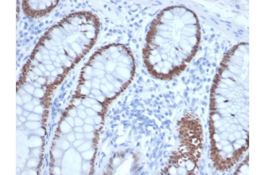 Immunohistochemistry - Anti-SATB2 Antibody [rSATB2/6929] (A277985) - Antibodies.com