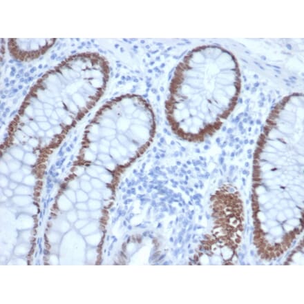 Immunohistochemistry - Anti-SATB2 Antibody [rSATB2/6929] (A277985) - Antibodies.com