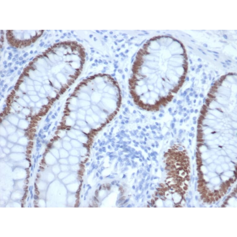 Immunohistochemistry - Anti-SATB2 Antibody [rSATB2/6929] (A277985) - Antibodies.com