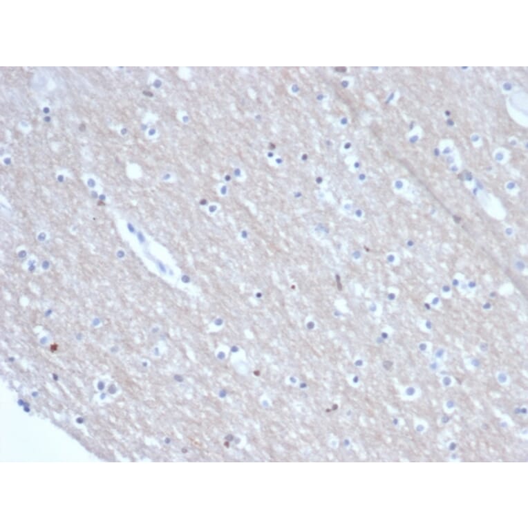 Immunohistochemistry - Anti-SATB2 Antibody [rSATB2/6929] (A277985) - Antibodies.com