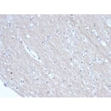 Immunohistochemistry - Anti-SATB2 Antibody [rSATB2/6929] (A277985) - Antibodies.com