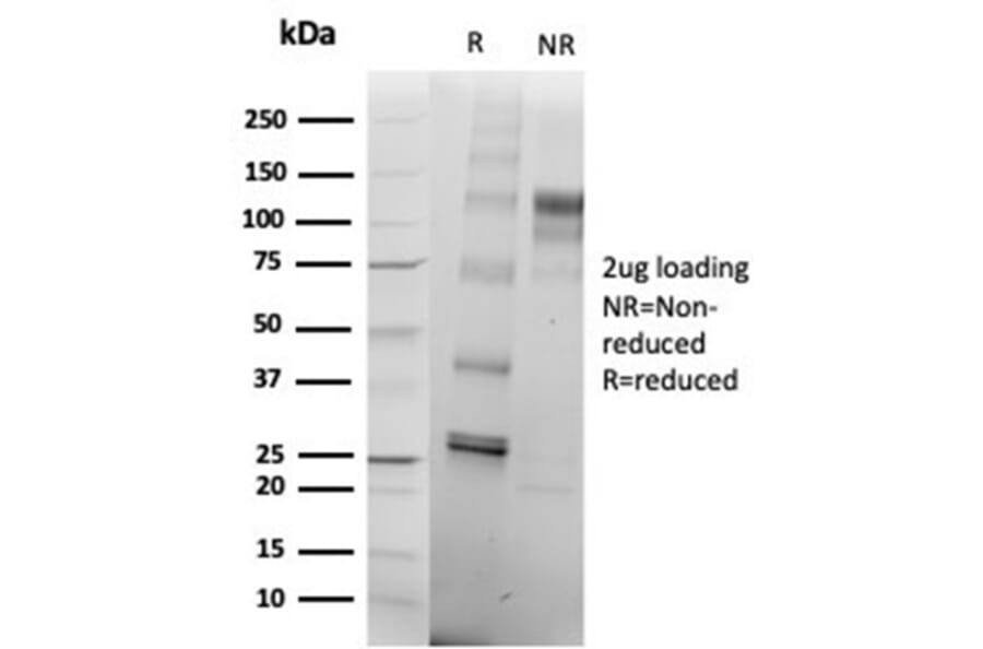 SDS-PAGE - Anti-SATB2 Antibody [rSATB2/6929] (A277985) - Antibodies.com