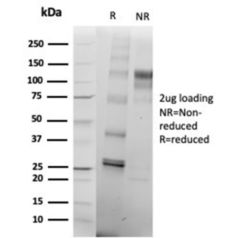 SDS-PAGE - Anti-SATB2 Antibody [rSATB2/6929] (A277985) - Antibodies.com