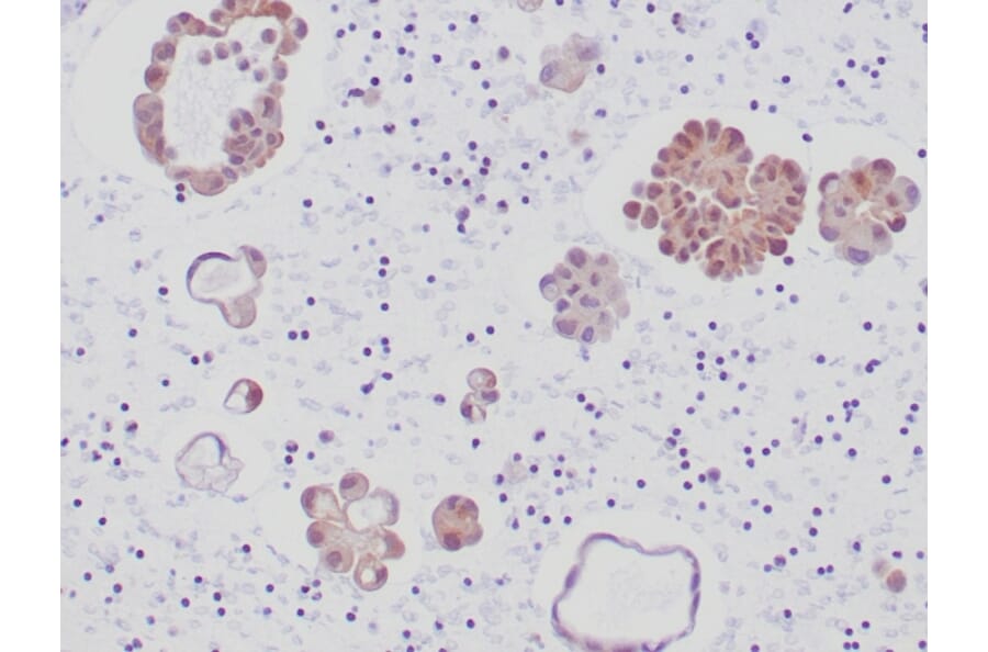 Immunohistochemistry - Anti-ALK Antibody [ALK1/6698R] (A277987) - Antibodies.com
