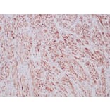 Immunohistochemistry - Anti-ALK Antibody [ALK1/6698R] (A277987) - Antibodies.com