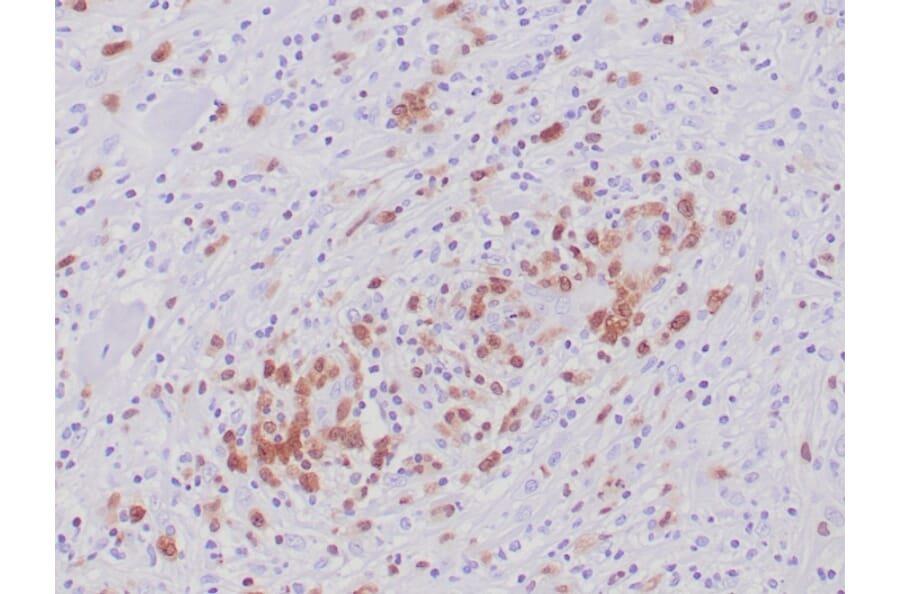 Immunohistochemistry - Anti-ALK Antibody [ALK1/6698R] (A277987) - Antibodies.com