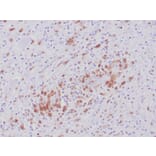 Immunohistochemistry - Anti-ALK Antibody [ALK1/6698R] (A277987) - Antibodies.com