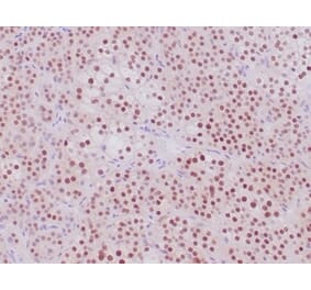 Immunohistochemistry - Anti-Steroidogenic Factor 1 Antibody [NR5A1/4368R] (A277988) - Antibodies.com