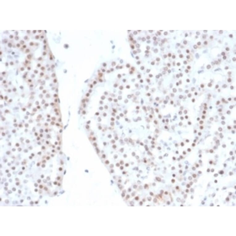 Immunohistochemistry - Anti-Steroidogenic Factor 1 Antibody [NR5A1/4368R] (A277988) - Antibodies.com