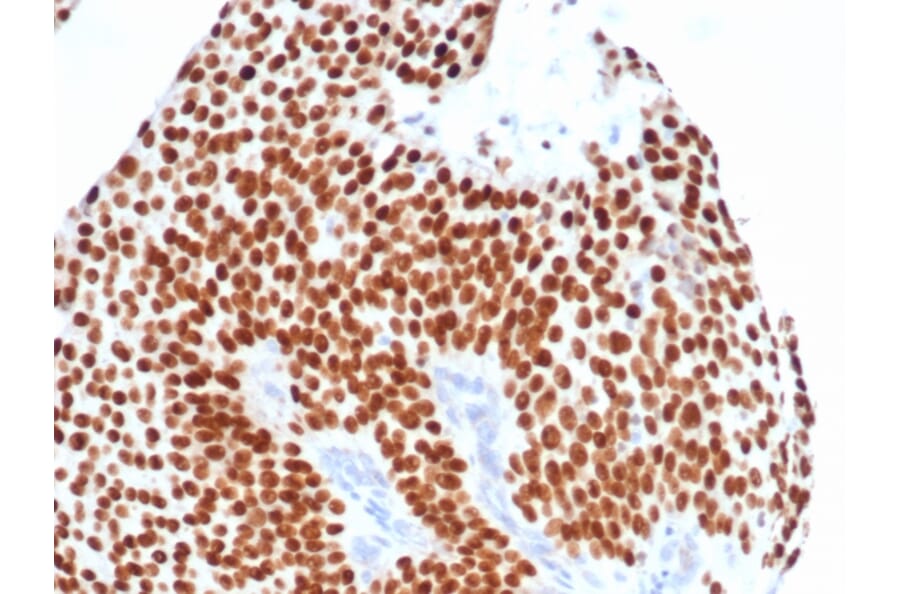 IHC - Recombinant Anti-GATA3 Antibody [GATA3/4550R] (A277989)