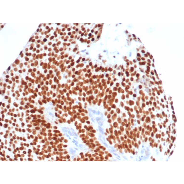 Immunohistochemistry - Anti-GATA3 Antibody [GATA3/4550R] (A277989) - Antibodies.com