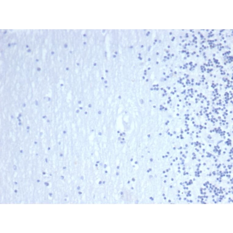 Immunohistochemistry - Anti-GATA3 Antibody [GATA3/4550R] (A277989) - Antibodies.com