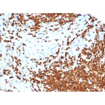 Immunohistochemistry - Anti-AMH Antibody [AMH/6713R] (A277990) - Antibodies.com