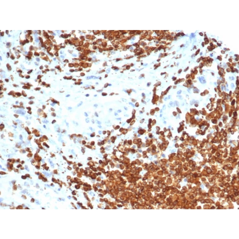 Immunohistochemistry - Anti-AMH Antibody [AMH/6713R] (A277990) - Antibodies.com